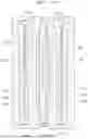Fig. 06 - FILTER FOR INFUSION MEDICAL LINES
