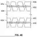 Fig. 07 - PEEL-AWAY SHEATH ASSEMBLY