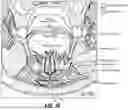 Fig. 10 - NEUROMODULATION DEVICES AND ASSOCIATED SYSTEMS AND METHODS