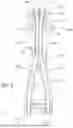 Fig. 07 - Zip line rail system
