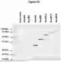 Fig. 03 - APOLIPOPROTEIN B (APOB) POLYPEPTIDES FOR BLOCKING ENDOTHELIAL CELL UPTAKE OF APOLIPOPROTEIN B-CONTAINING LIPOPROTEINS