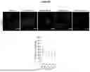 Fig. 05 - APOLIPOPROTEIN B (APOB) POLYPEPTIDES FOR BLOCKING ENDOTHELIAL CELL UPTAKE OF APOLIPOPROTEIN B-CONTAINING LIPOPROTEINS