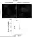 Fig. 14 - APOLIPOPROTEIN B (APOB) POLYPEPTIDES FOR BLOCKING ENDOTHELIAL CELL UPTAKE OF APOLIPOPROTEIN B-CONTAINING LIPOPROTEINS