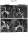 Fig. 23 - APOLIPOPROTEIN B (APOB) POLYPEPTIDES FOR BLOCKING ENDOTHELIAL CELL UPTAKE OF APOLIPOPROTEIN B-CONTAINING LIPOPROTEINS
