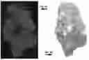 Fig. 06 - DIGITAL SYNTHESIS OF HISTOLOGICAL STAINS USING MULTIPLEXED IMMUNOFLUORESCENCE IMAGING