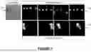 Fig. 06 - TWO-DIMENSIONAL POSE ESTIMATION BASED ON BIPARTITE MATCHING OF JOINT TYPE HEATMAPS AND JOINT PERSON HEATMAPS