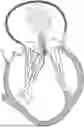 Fig. 01 - CATHETER-GUIDED REPLACEMENT VALVES APPARATUS AND METHODS