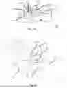 Fig. 09 - SURGICAL MASTER-SLAVE ROBOT