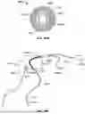 Fig. 167 - Vapor Based Ablation System for Treating Various Indications