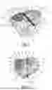 Fig. 02 - SURGICAL INSTRUMENT TO IMPLANT PRIMARY AND SECONDARY ELEMENTS