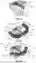 Fig. 07 - SURGICAL INSTRUMENT TO IMPLANT PRIMARY AND SECONDARY ELEMENTS