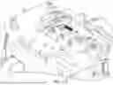 Fig. 197 - APPARATUS FOR INFUSING FLUID