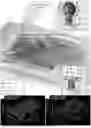 Fig. 01 - METHOD FOR PREPARING SOLVENT-FREE 3D BIOLOGICAL BILAYER MEMBRANE STRUCTURE IN PHYSIOLOGICAL SOLUTION AND 3D BIOLOGICAL BILAYER MEMBRANE STRUCTURE USING THE SAME