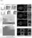 Fig. 07 - METHOD FOR PREPARING SOLVENT-FREE 3D BIOLOGICAL BILAYER MEMBRANE STRUCTURE IN PHYSIOLOGICAL SOLUTION AND 3D BIOLOGICAL BILAYER MEMBRANE STRUCTURE USING THE SAME