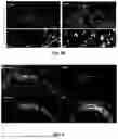 Fig. 06 - METHOD