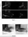Fig. 11 - METHOD