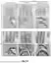 Fig. 13 - METHOD