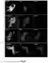 Fig. 20 - METHOD