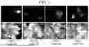 Fig. 02 - Methods for plant transformation using spectinomycin selection