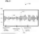 Fig. 06 - SYLLABLE-BASED TEXT CONVERSION FOR PRONUNCIATION HELP