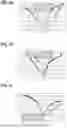 Fig. 06 - DEVICES AND METHODS FOR READING A MEMRISTIVE ELEMENT