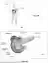 Fig. 07 - Interactive bodymap systems and machine learning methods