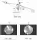Fig. 11 - IN-VIVO VISUALIZATION SYSTEMS