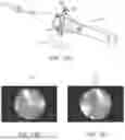 Fig. 14 - IN-VIVO VISUALIZATION SYSTEMS