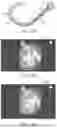 Fig. 15 - IN-VIVO VISUALIZATION SYSTEMS
