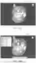 Fig. 16 - IN-VIVO VISUALIZATION SYSTEMS