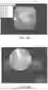 Fig. 17 - IN-VIVO VISUALIZATION SYSTEMS