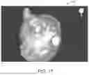 Fig. 18 - IN-VIVO VISUALIZATION SYSTEMS