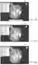 Fig. 19 - IN-VIVO VISUALIZATION SYSTEMS