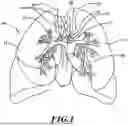 Fig. 02 - APPARATUSES AND METHODS FOR INJURING NERVE TISSUE