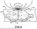 Fig. 07 - APPARATUSES AND METHODS FOR INJURING NERVE TISSUE