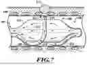 Fig. 08 - APPARATUSES AND METHODS FOR INJURING NERVE TISSUE