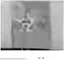 Fig. 34 - ROBOTIC NAVIGATION OF ROBOTIC SURGICAL SYSTEMS