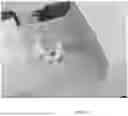Fig. 35 - ROBOTIC NAVIGATION OF ROBOTIC SURGICAL SYSTEMS