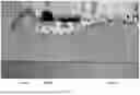 Fig. 40 - ROBOTIC NAVIGATION OF ROBOTIC SURGICAL SYSTEMS