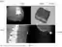 Fig. 41 - ROBOTIC NAVIGATION OF ROBOTIC SURGICAL SYSTEMS