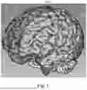 Fig. 02 - AUTOMATED METHOD FOR DETERMINING THE SAFETY OF A STEREOTACTIC SURGICAL TRAJECTORY