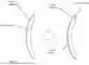 Fig. 02 - BIOENGINEERED CORNEAL GRAFTS