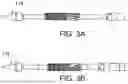 Fig. 04 - SYSTEMS AND METHODS FOR PREDICTABLE COMMISSURAL ALIGNMENT OF A REPLACEMENT HEART VALVE