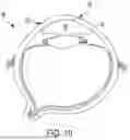 Fig. 07 - MULTIFUNCTION OPHTHALMIC BLADE