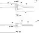Fig. 02 - Glaucoma shunts and related methods of use