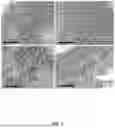 Fig. 02 - CCR4-Targeting Chimeric Antigen Receptor Cell Therapy