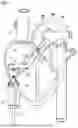 Fig. 02 - BLOOD PUMP WITH FILTER