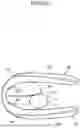 Fig. 22 - Airbag device and passenger protection device
