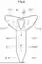 Fig. 09 - Airbag device and passenger protection device