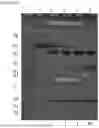 Fig. 33 - VEGF TRAPS AND MINI-TRAPS AND METHODS FOR TREATING OCULAR DISORDERS AND CANCER